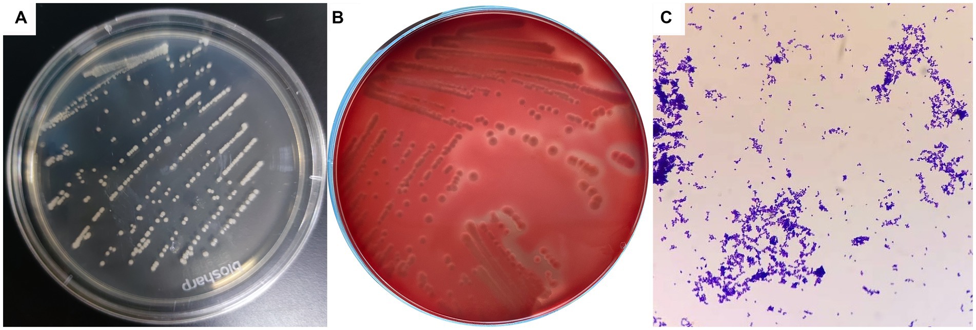 Frontiers | Isolation, characterization, and pathogenicity assessment ...