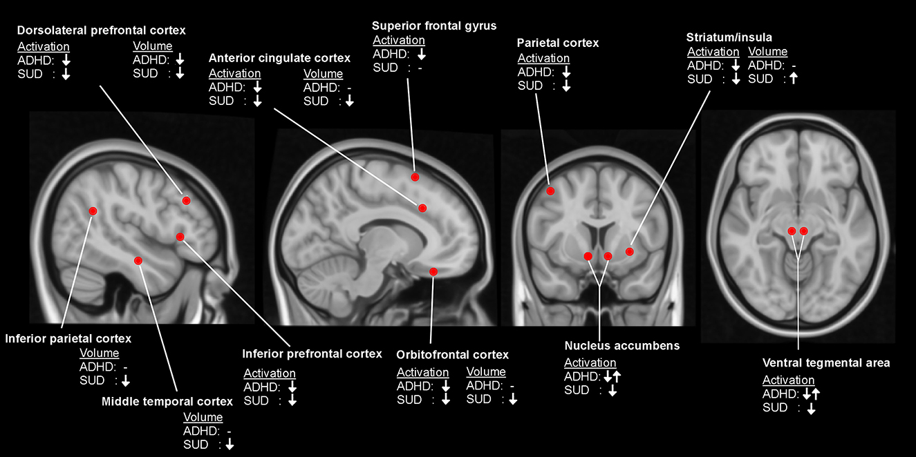 Region-Specific Effects of Nicotine on Brain Activity: A Pharmacological  MRI Study in the Drug-Naïve Rat