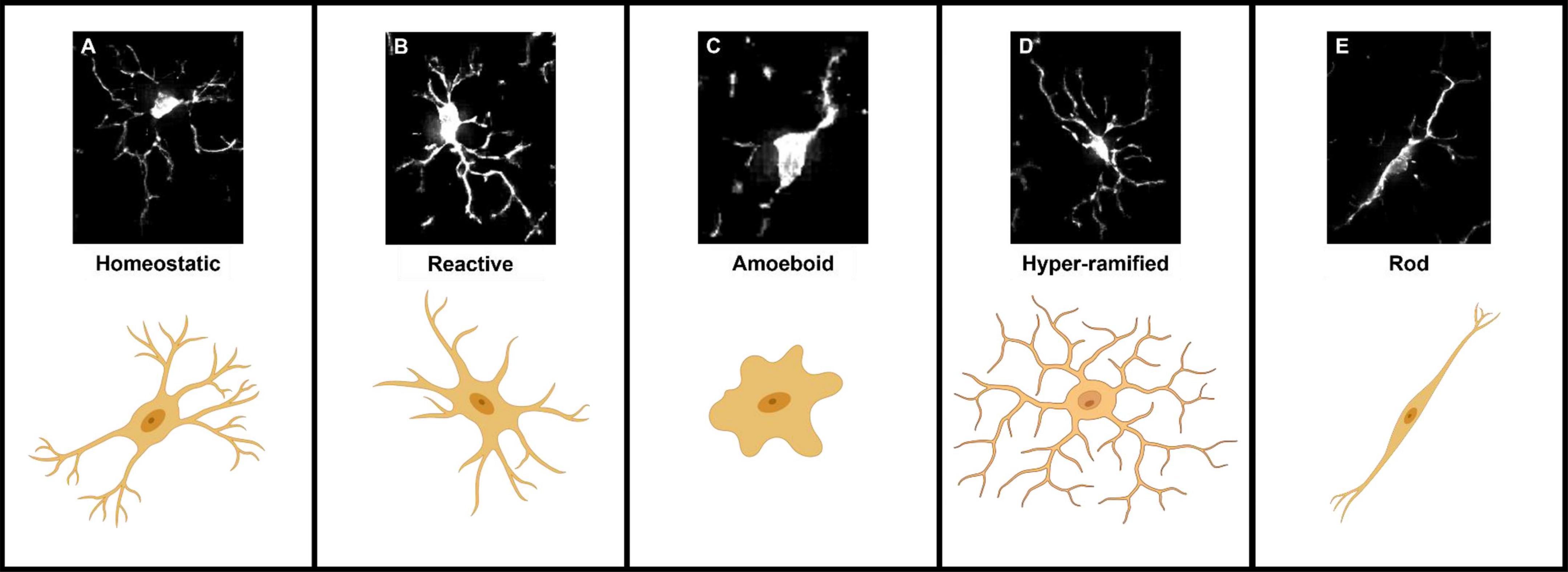 Breast cancer evaluation by fluorescent dot detection using combined  mathematical morphology and multifractal techniques, Diagnostic Pathology