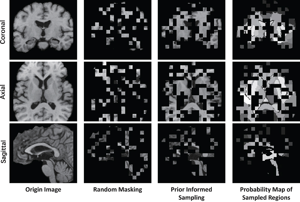 Leveraging Datature Nexus for Tumor and Anomaly Detection in Medical Scans  : Part I
