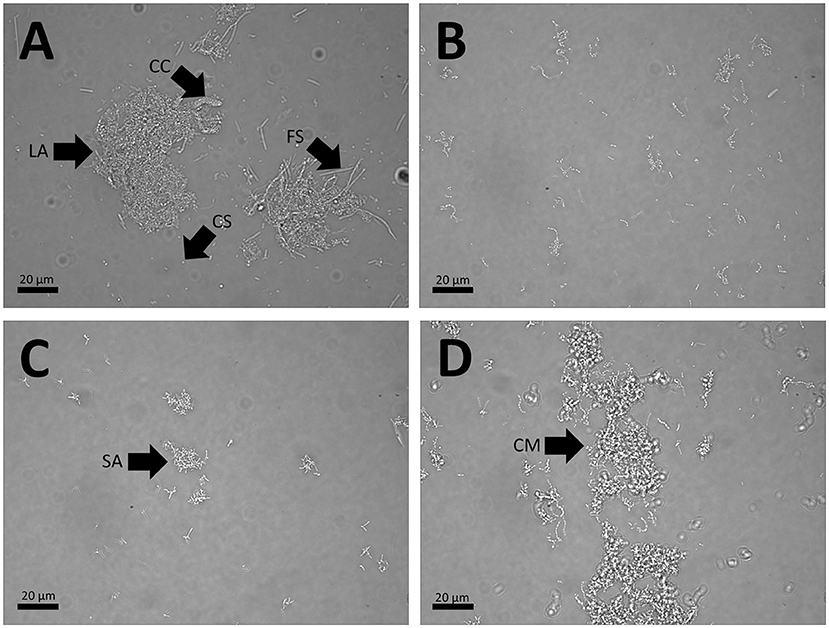 Figure 1 - Microscopic images of aggregates and coaggregates.