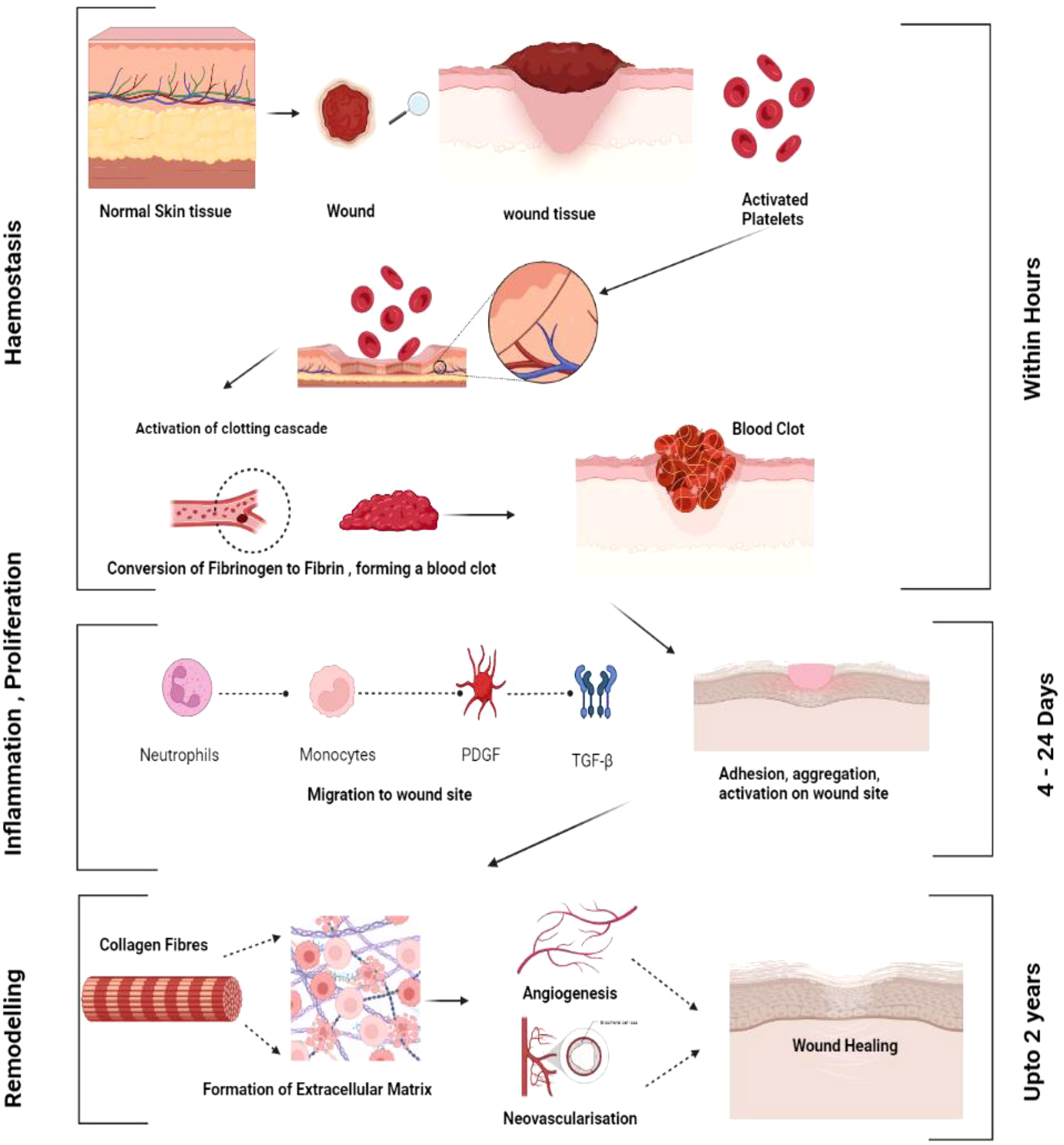 Frontiers  Exploring the contribution of pro-inflammatory cytokines to  impaired wound healing in diabetes