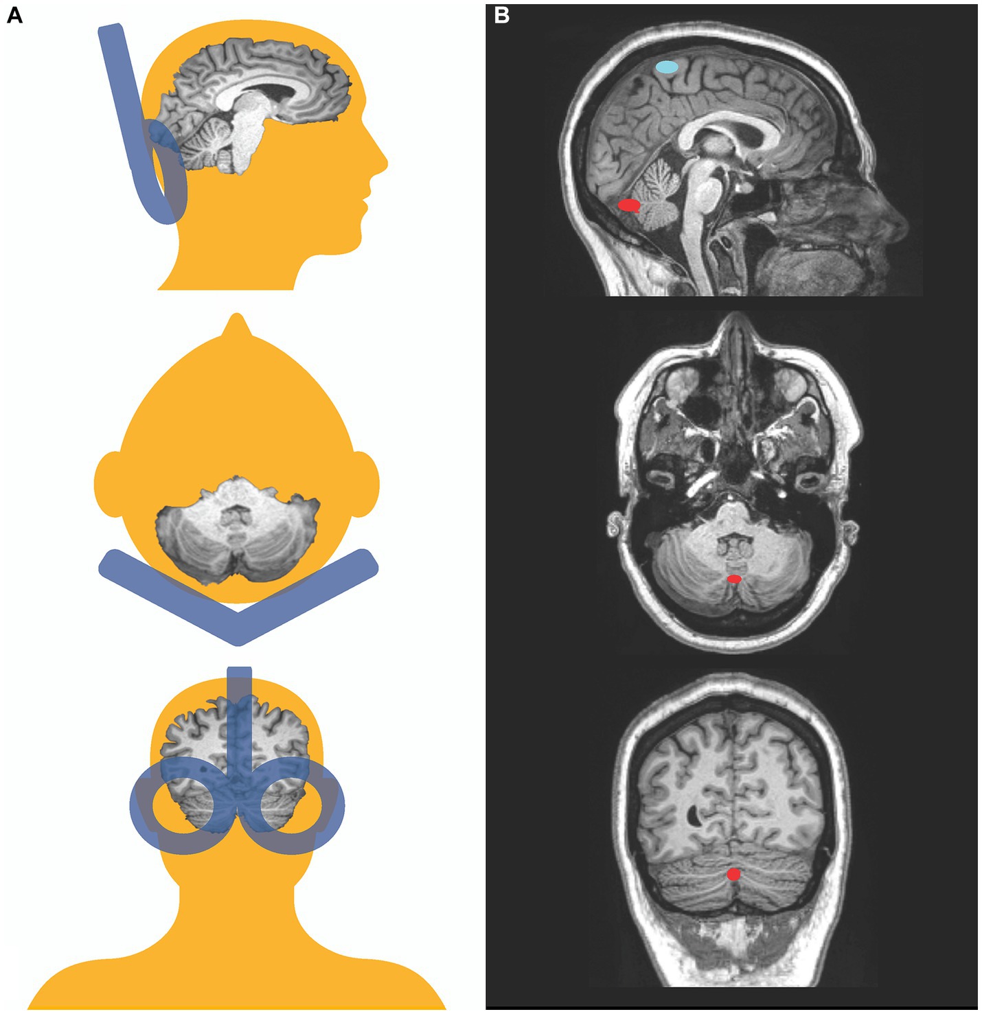 Not only is it fun… Play Billiards for Brain and Body Health - Bradys