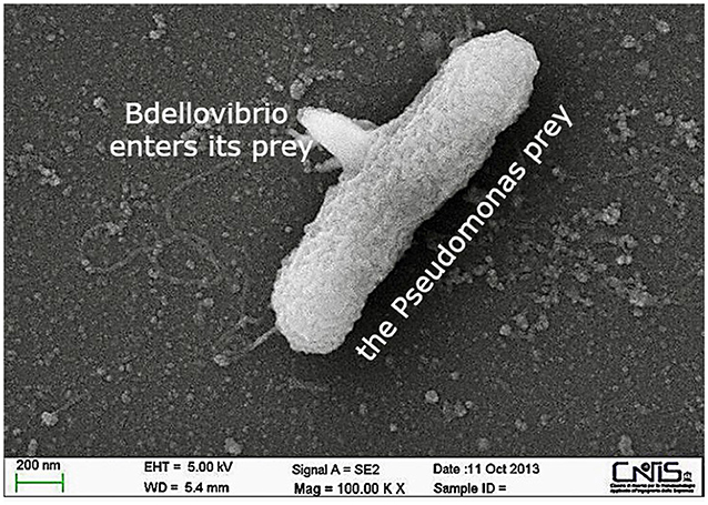Figure 1 - Microscope image of the small predator Bdello attacking the bigger, harmful, and frequently antibiotic-resistant bacterium Pseudomonas aeruginosa (Image obtained in our university laboratories at Sapienza University of Rome-Italy).