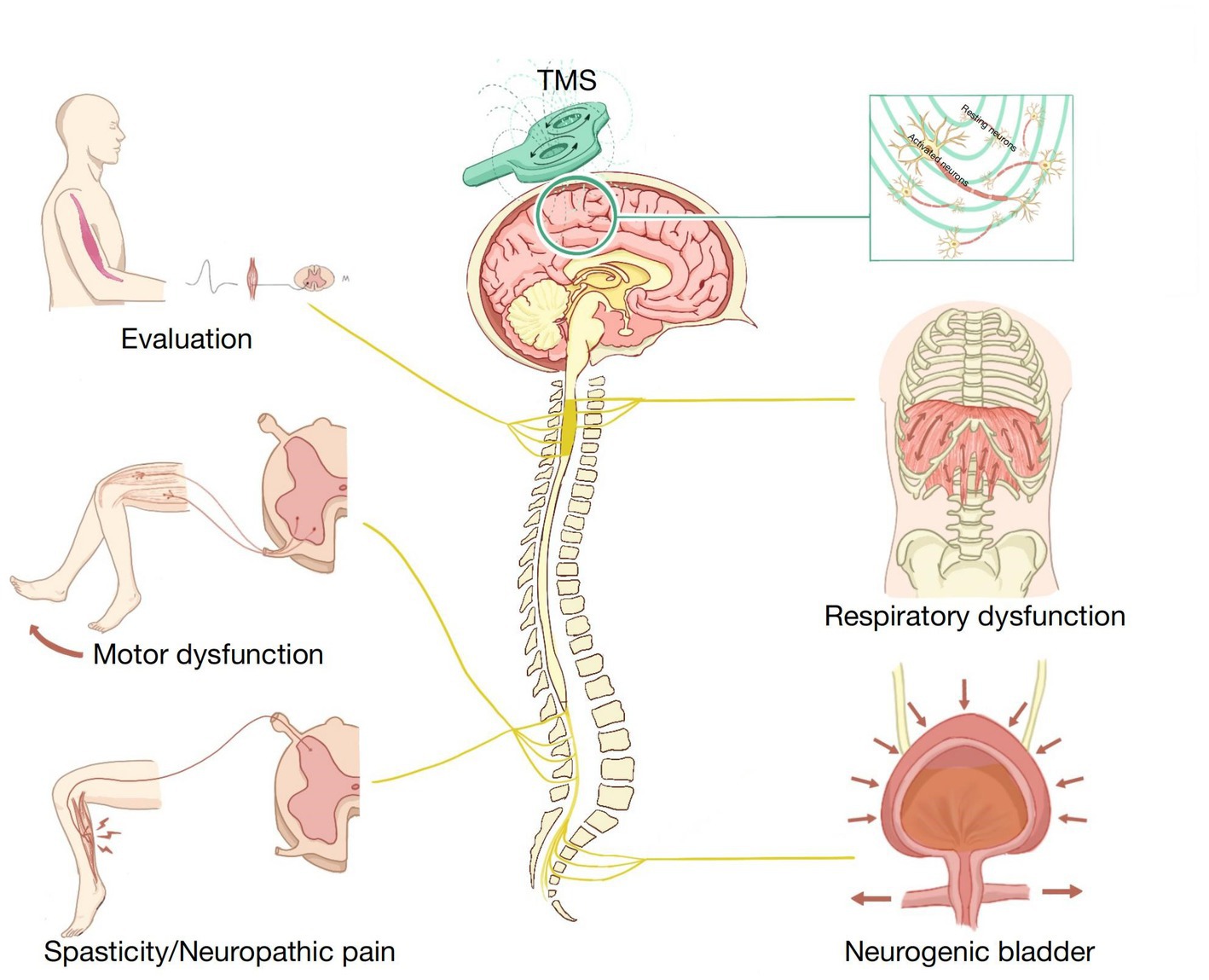 File:Neuromuscular electrical stimulation promoted brain plasticity.jpg -  Wikimedia Commons