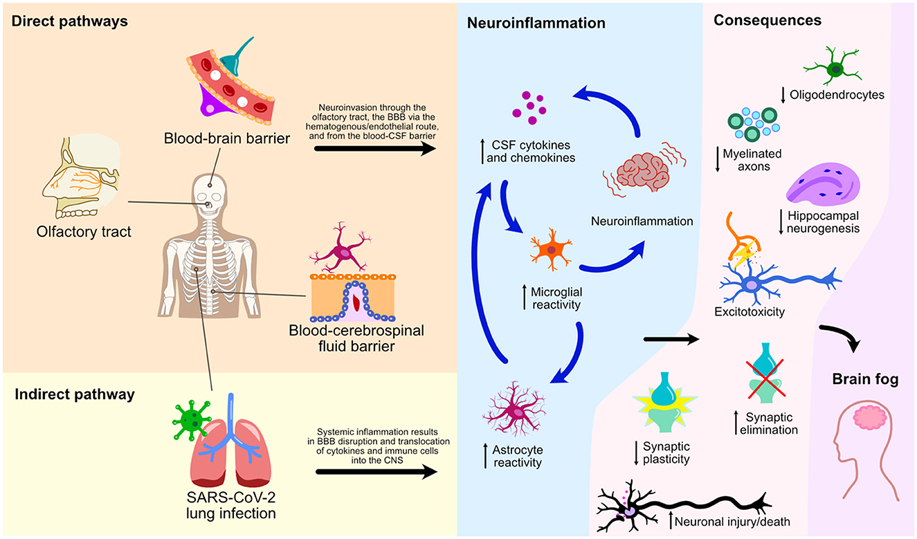 Stroke subtype-dependent synapse elimination by reactive gliosis in mice