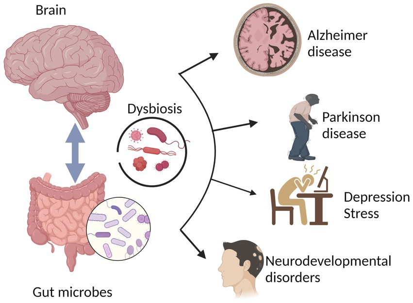 Finally a brain test showed which medications would help. - The  NeuroDevelopment Center