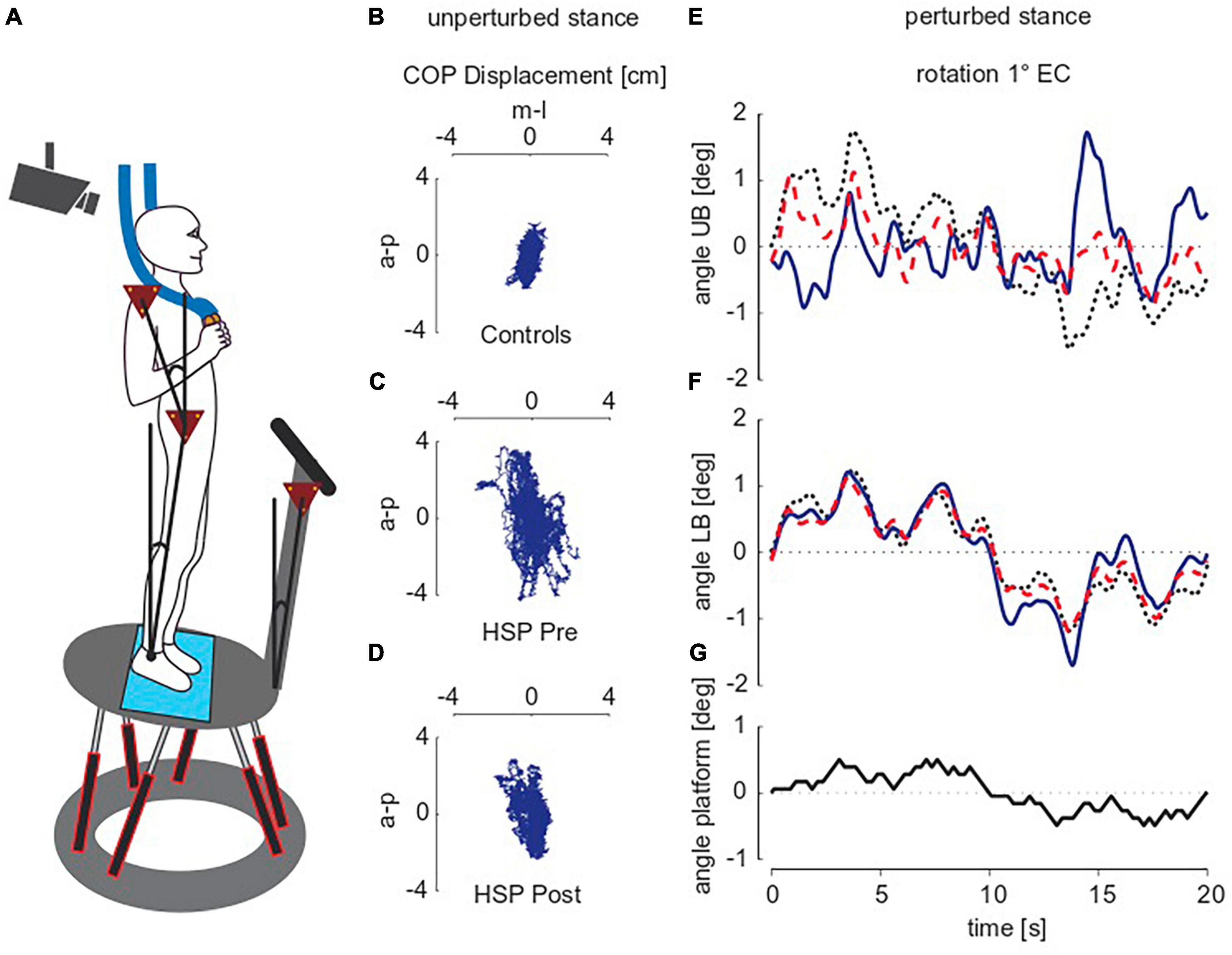 Mean amplitude of intraocular pressure excursions: a new