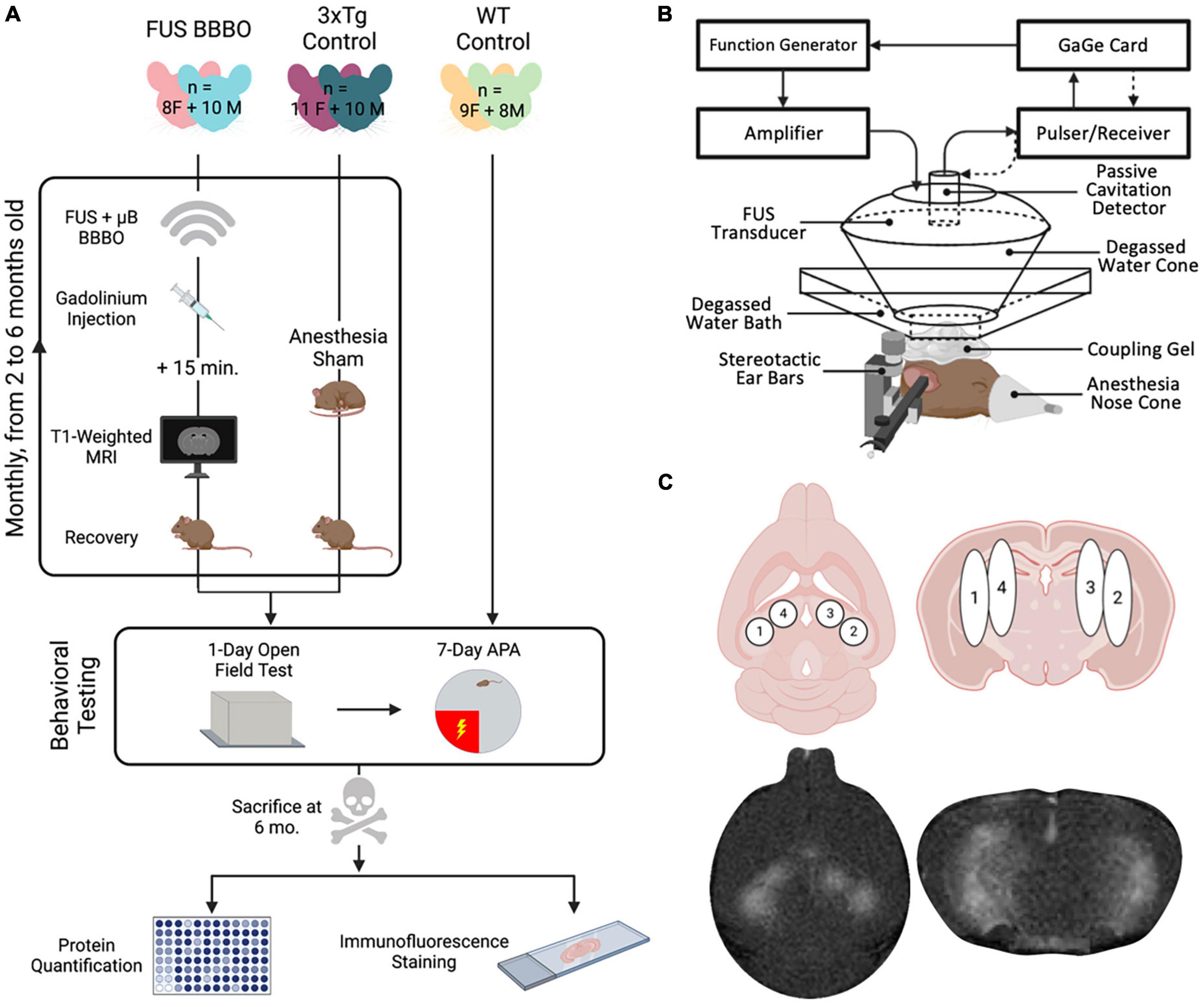 Frontiers | Getting ahead of Alzheimer’s disease: early intervention