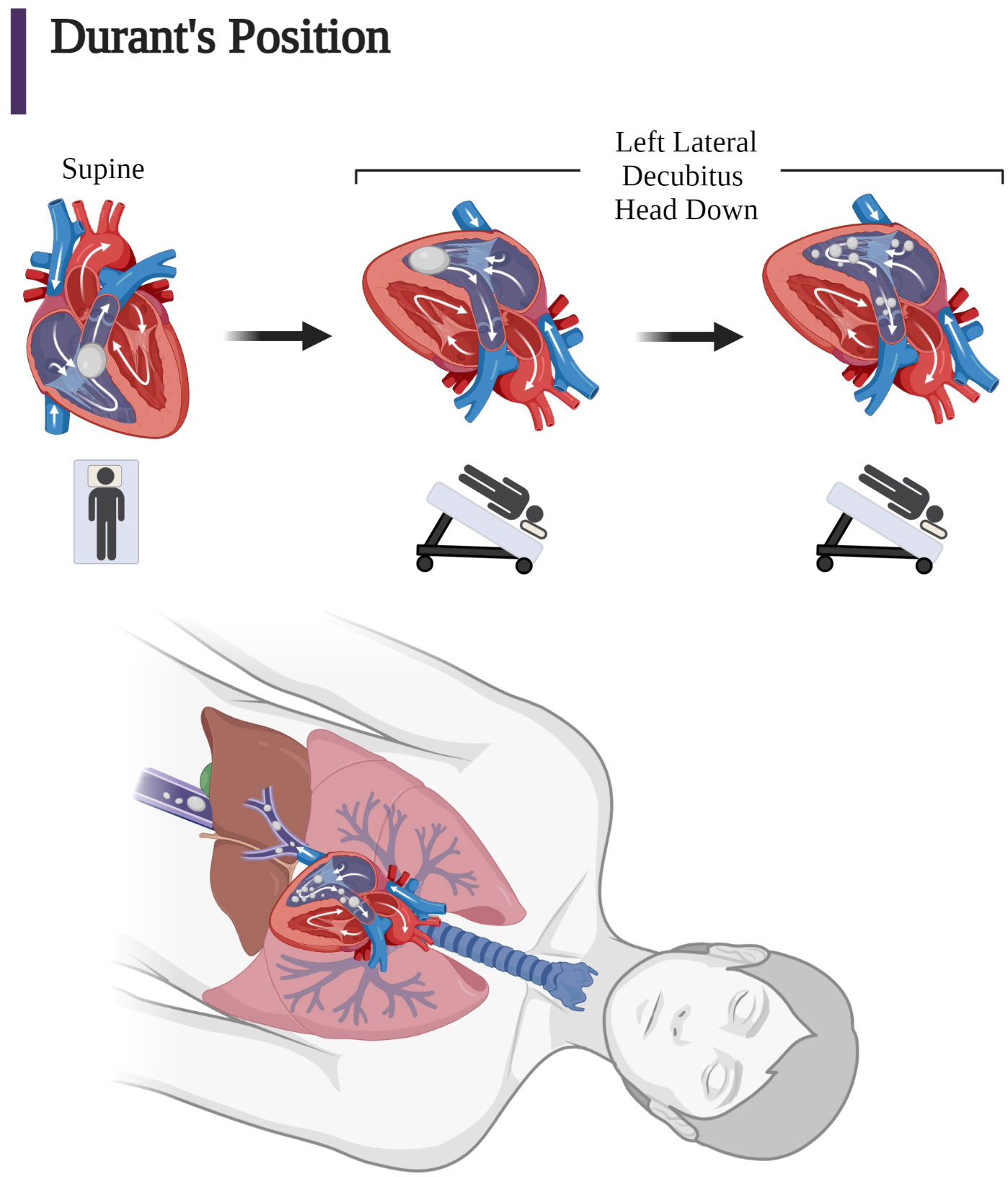 Managing Luer Connections - Anesthesia Patient Safety Foundation