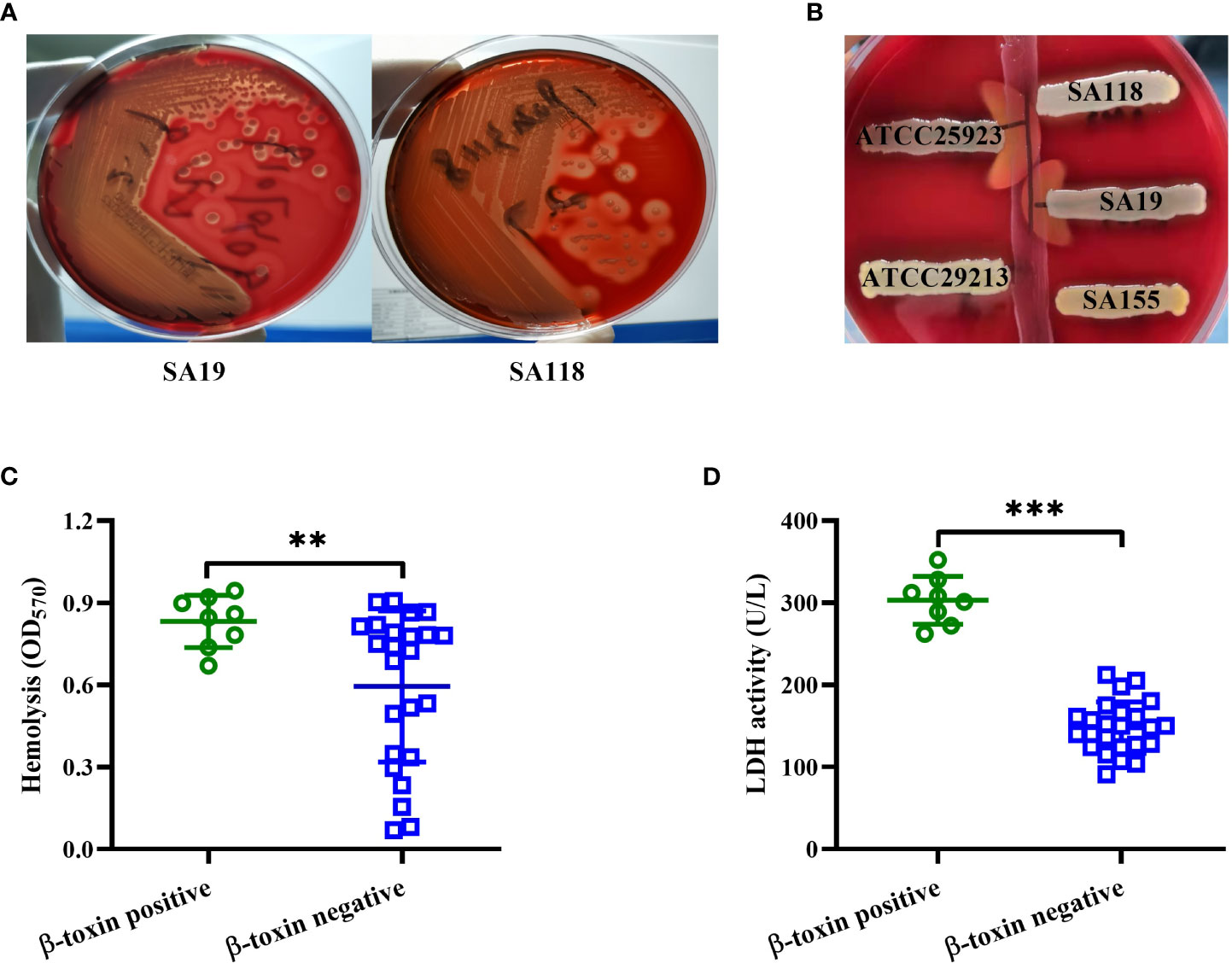 Hyperglycemia in Diabetic Skin Infections Promotes Staphylococcus aureus  Virulence Factor Aureolysin: Visualization by Molecular Imaging