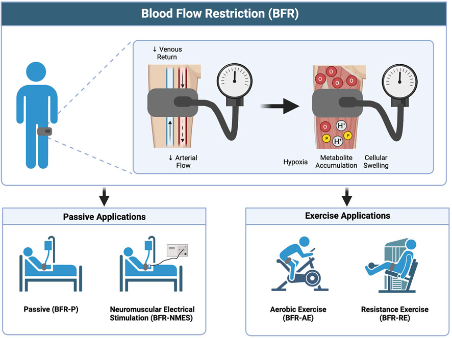 Electrical Muscle Stimulation, United States - OSR Physical Therapy