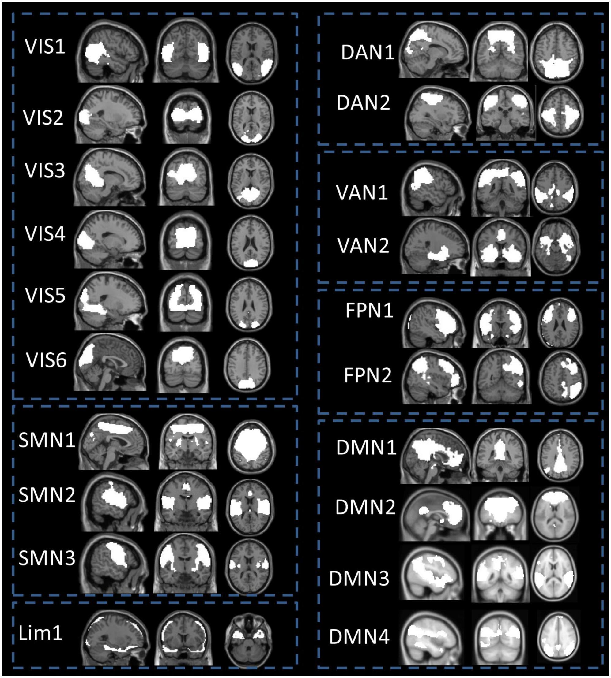 Frontiers  Abnormal brain spontaneous activity in major