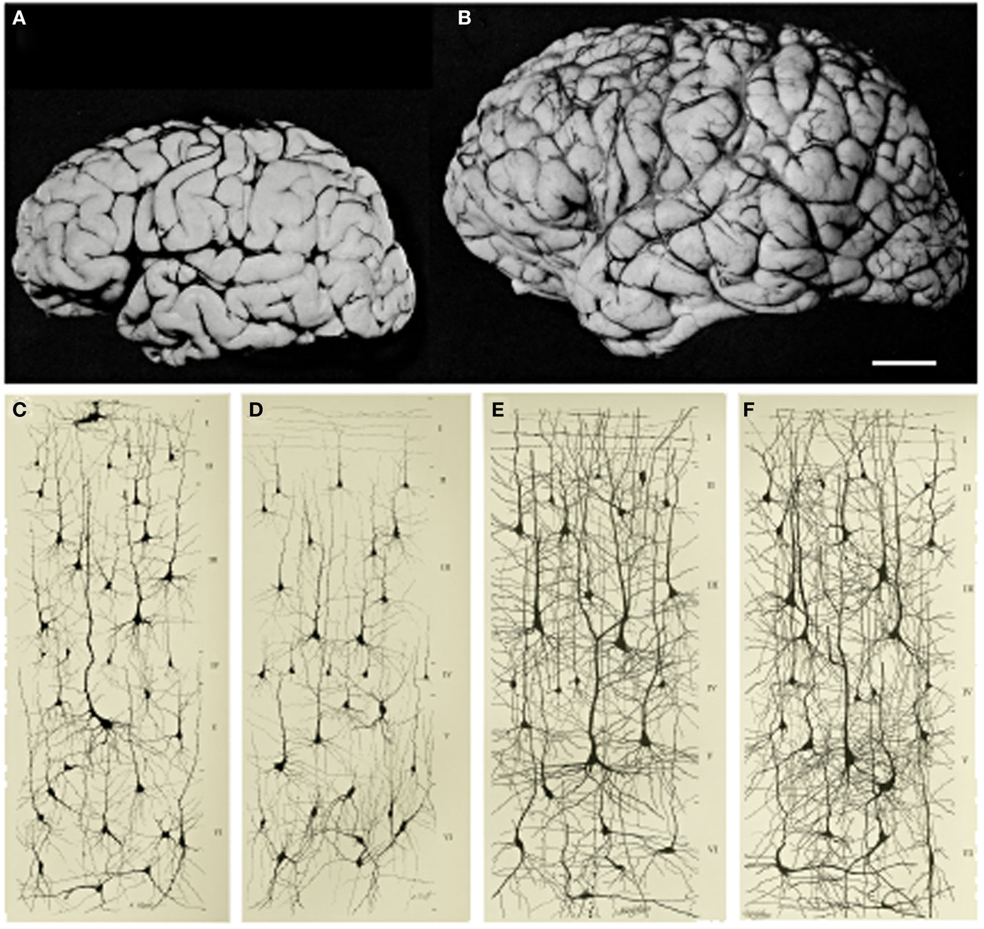 Figure 1 - Increase in brain size and the maturation of cortical circuits.