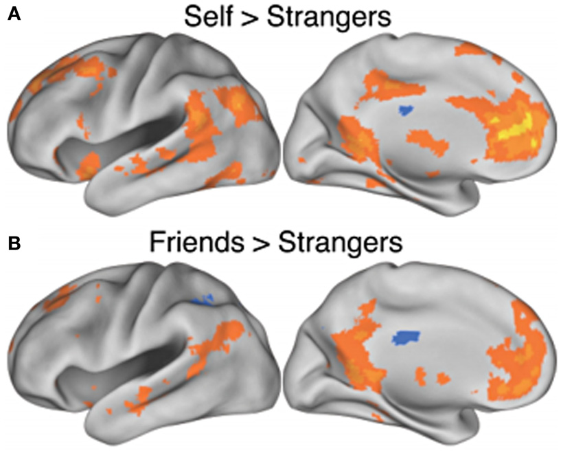 Figure 2 - Brain activity.