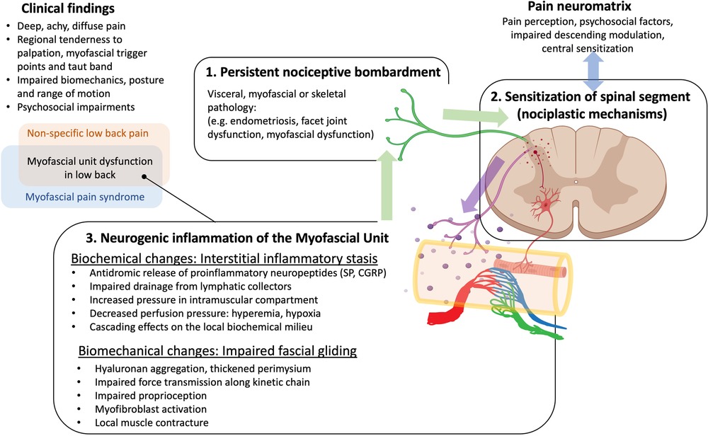 Better Understanding Myofascial Pain – Consult QD