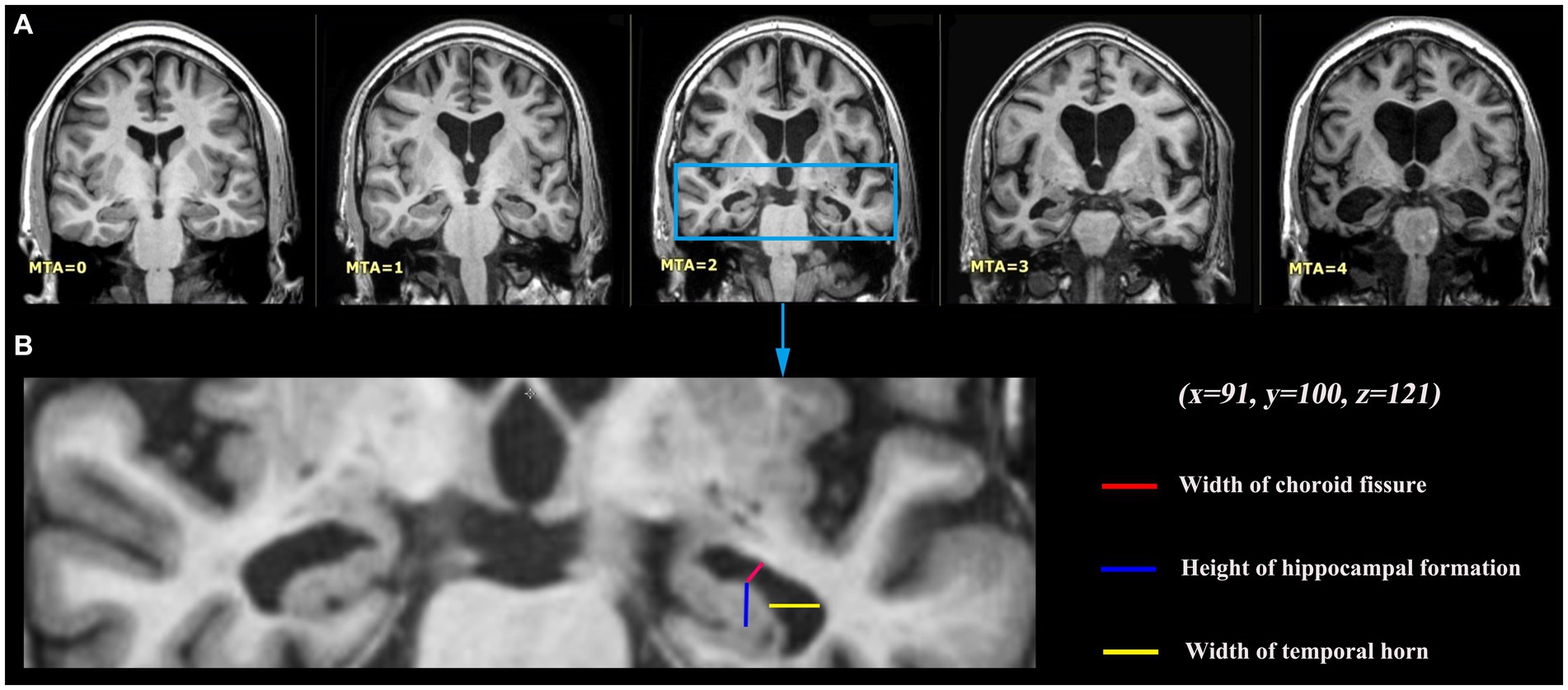 The X-ray scanner is used to investigate a discrepancy in sex