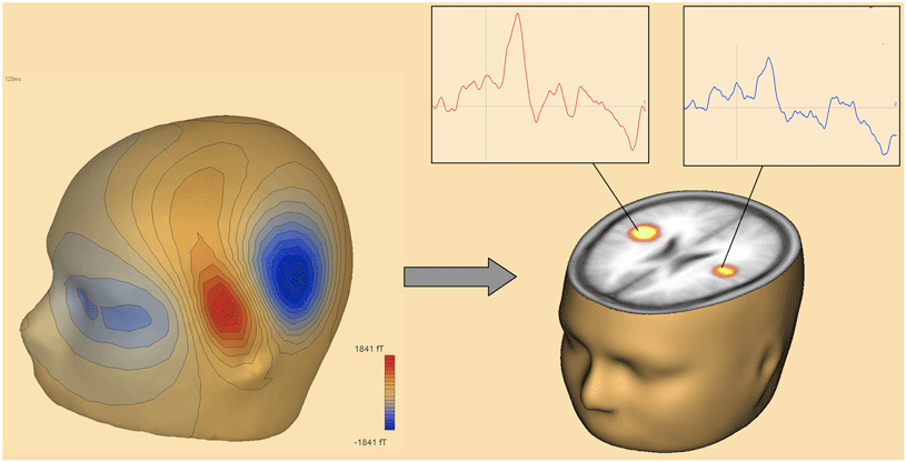 Figure 5 - The picture on the left shows the magnetic fields produced by listening to lots of beeps.