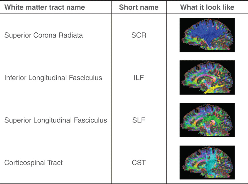 טבלה 1 - טבלה זו מציגה חלק מאסופות (tracts) החומר הלבן במוח: את שְׁמָן המלא (משמאל), את שמן המקוצר (באמצע) ואת איך שהן נראות בסריקת DTI של המוח (מצד ימין).