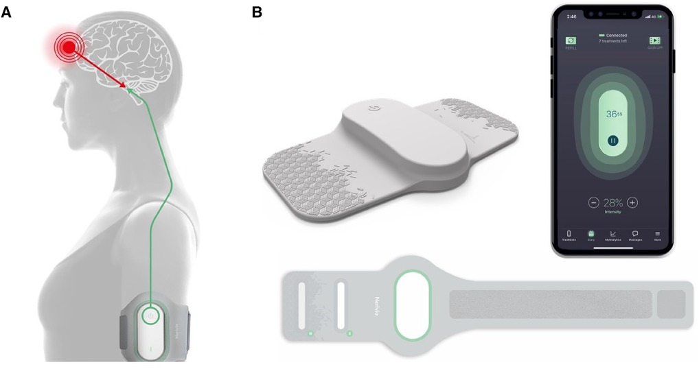 Frequency-specific neuromodulation of local and distant