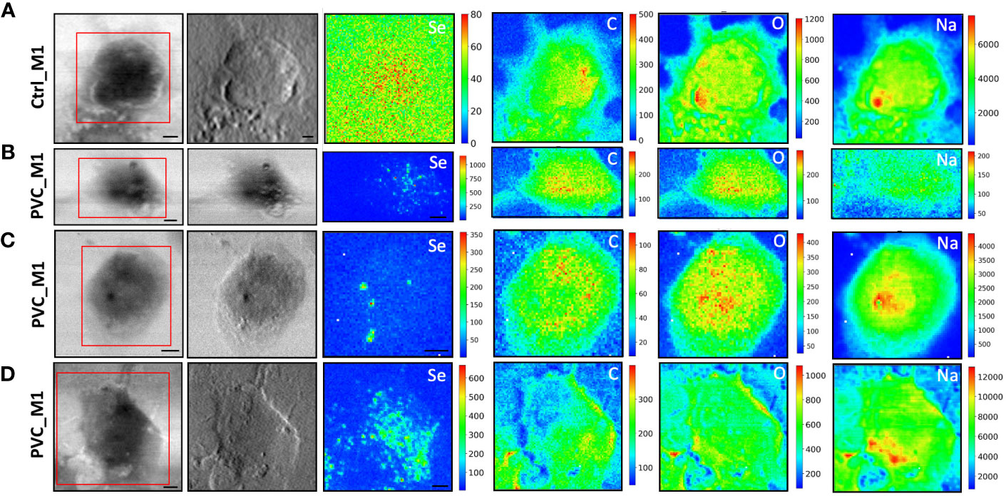 Frontiers | Morphological and lipid metabolism alterations in ...