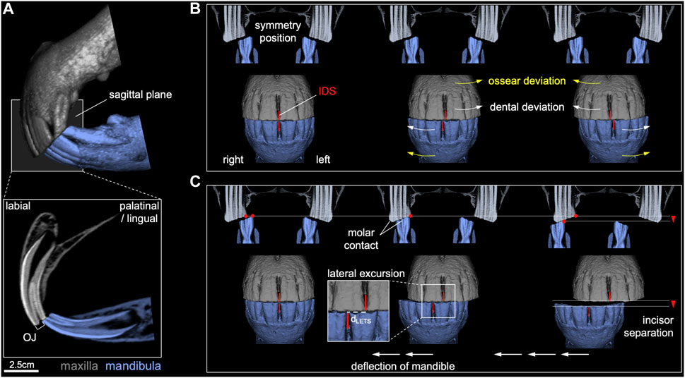 Essential requirements of a non-occlusal mandibu- lar reference position