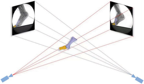 Frontiers  Effects of different habitual foot strike patterns on in vivo  kinematics of the first metatarsophalangeal joint during shod running—a  statistical parametric mapping study