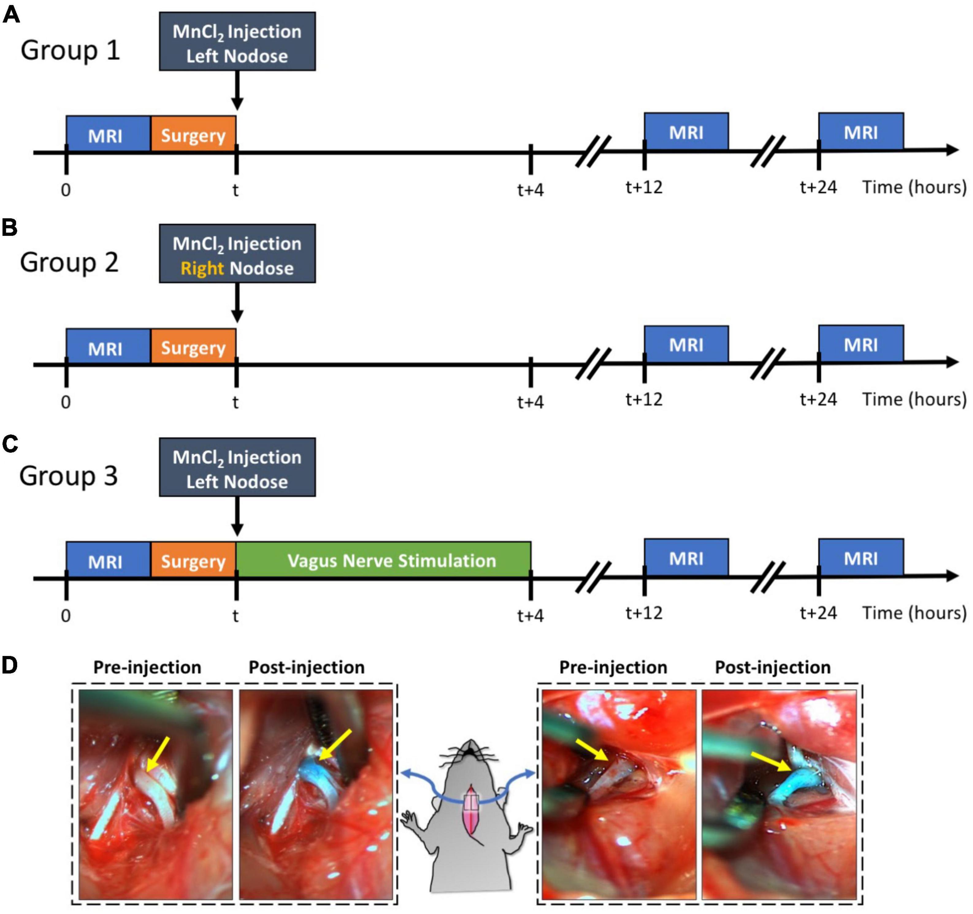 The vagus afferent network: emerging role in translational connectomics in:  Neurosurgical Focus Volume 45 Issue 3 (2018) Journals