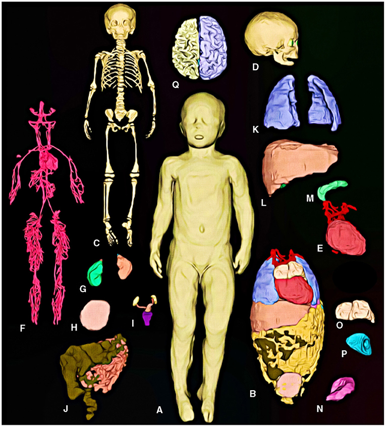 Figure 3 - Using our computer model, which we named Athena, you can see: (A) the skin; (B) the organs; (C) the bones; (D) the skull; (E) the heart; (F) the blood vessels; (G) the kidneys; (H) the urinary bladder; (I) the reproductive system, including the ovaries, uterus, cervix, and fallopian tubes; (J) the bowel; (K) the lungs; (L) the liver; (M) the pancreas; (N) the stomach; (O) the thymus; (P) the spleen; and (Q) the brain.