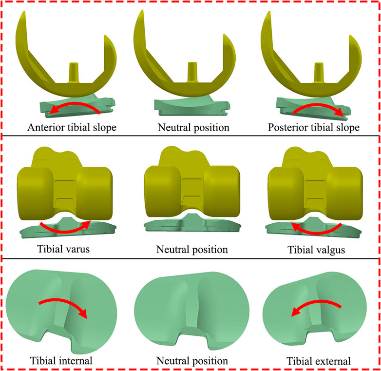 Influence of intentional femoral component flexion in navigated