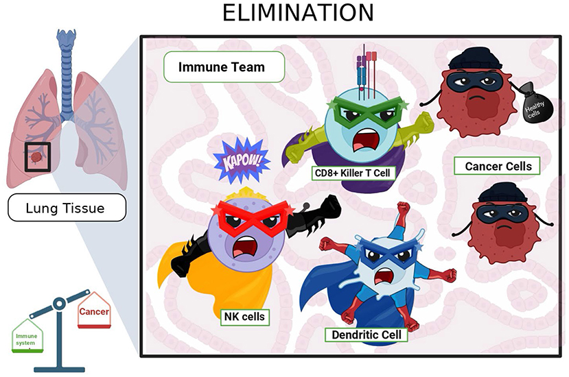 Illustration showing an “Elimination” theme with the immune system fighting cancer cells in lung tissue. The “Immune Team” includes CD8+ Killer T Cell, NK cells, and Dendritic Cell, depicted as superheroes attacking cancer cells. The background shows lung tissue, and a small diagram compares the immune system (up) and cancer (down).