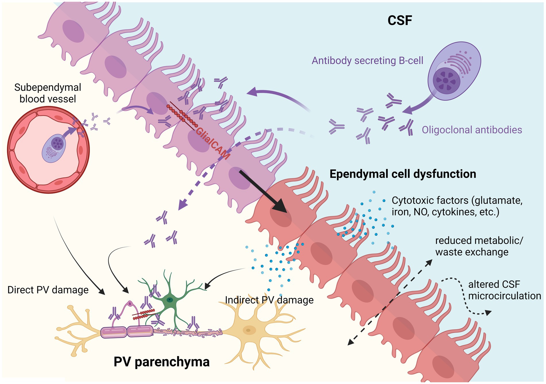 Frontiers | Pathogenic role of autoantibodies at the ependyma in ...