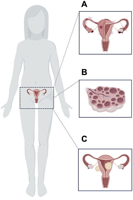 Figure 3 - Three common causes of irregularities in the menstrual cycle.