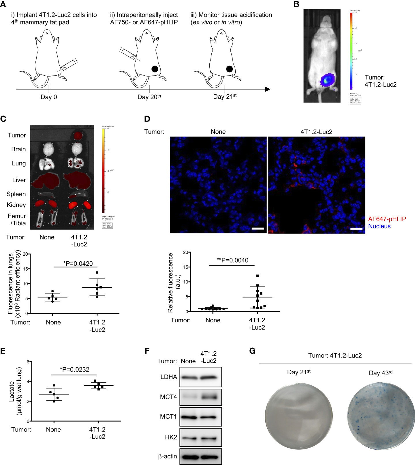 Frontiers  Targeting acidic pre-metastatic niche in lungs by pH low  insertion peptide and its utility for anti-metastatic therapy