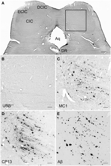 Frontiers - Localization of mutant ubiquitin in the brain of a transgenic mouse line with ...