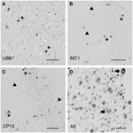 Frontiers - Localization of mutant ubiquitin in the brain of a transgenic mouse line with ...