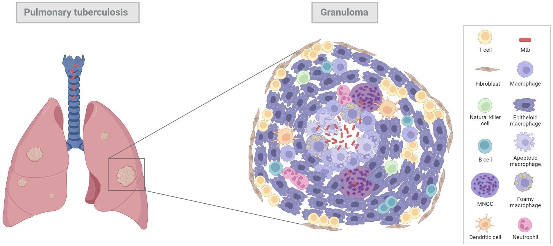 Frontiers | Comparative pathology of experimental pulmonary tuberculosis in  animal models