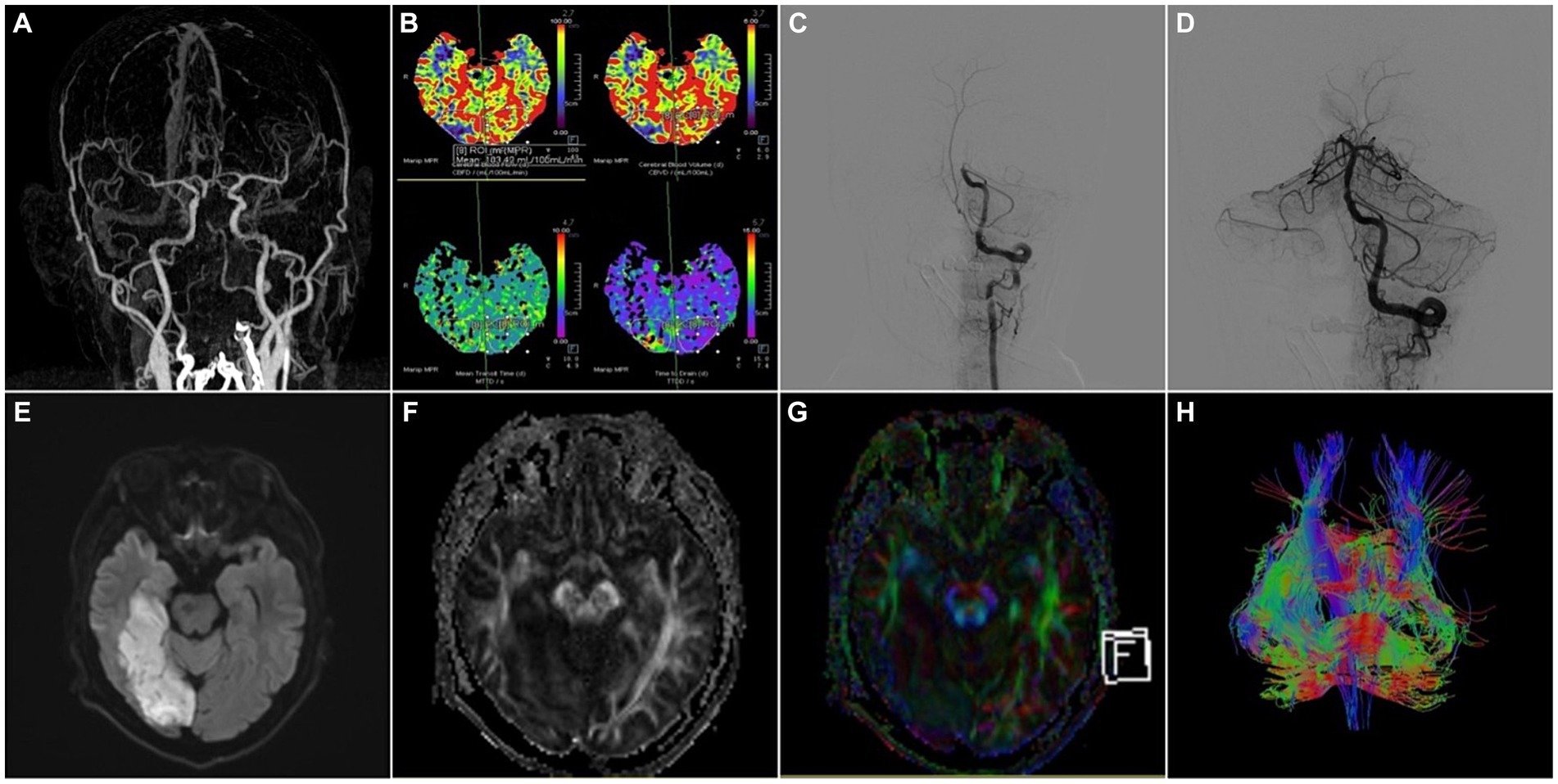 Frontiers | The novel imaging methods in diagnosis and