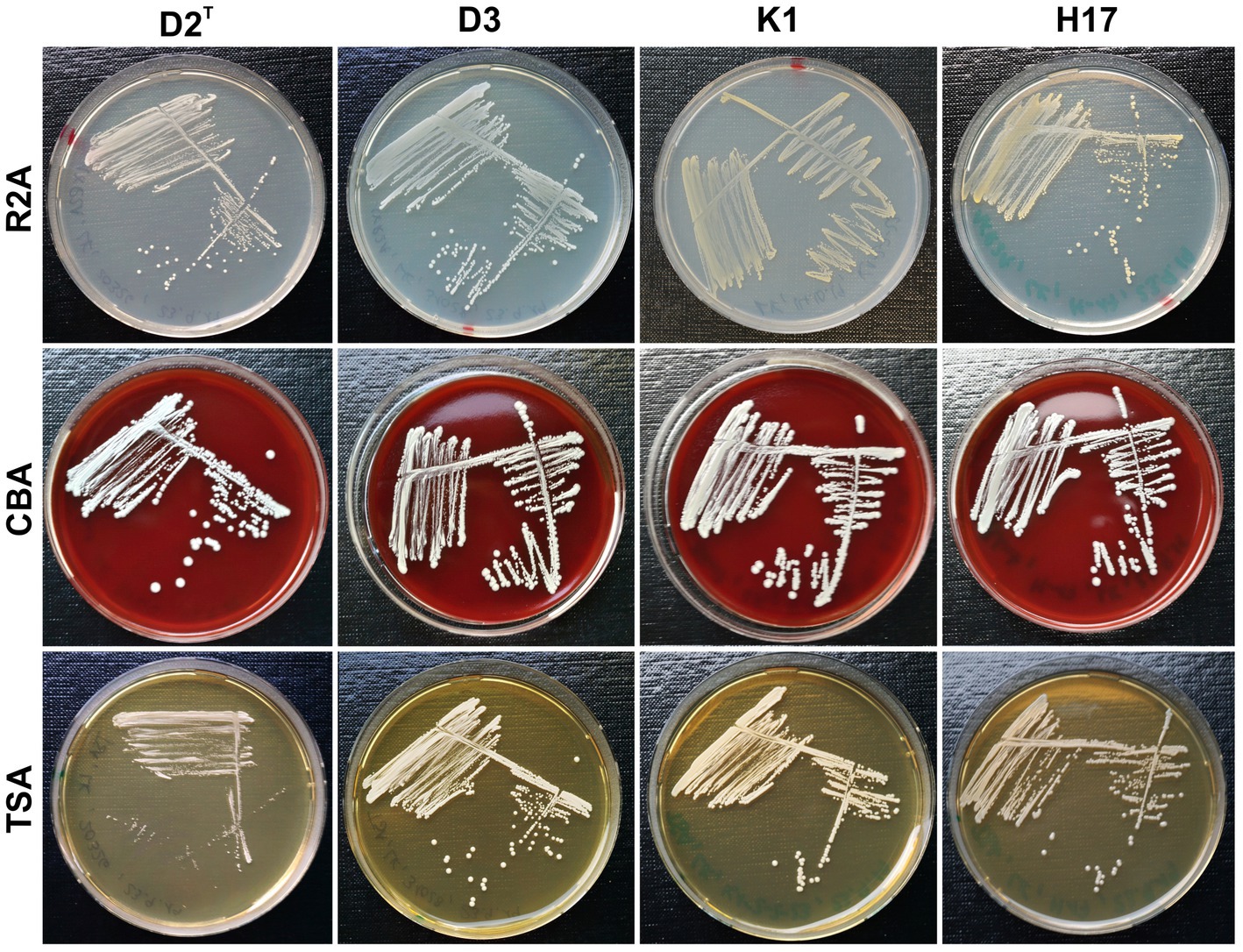 staphylococcus epidermidis streak plate