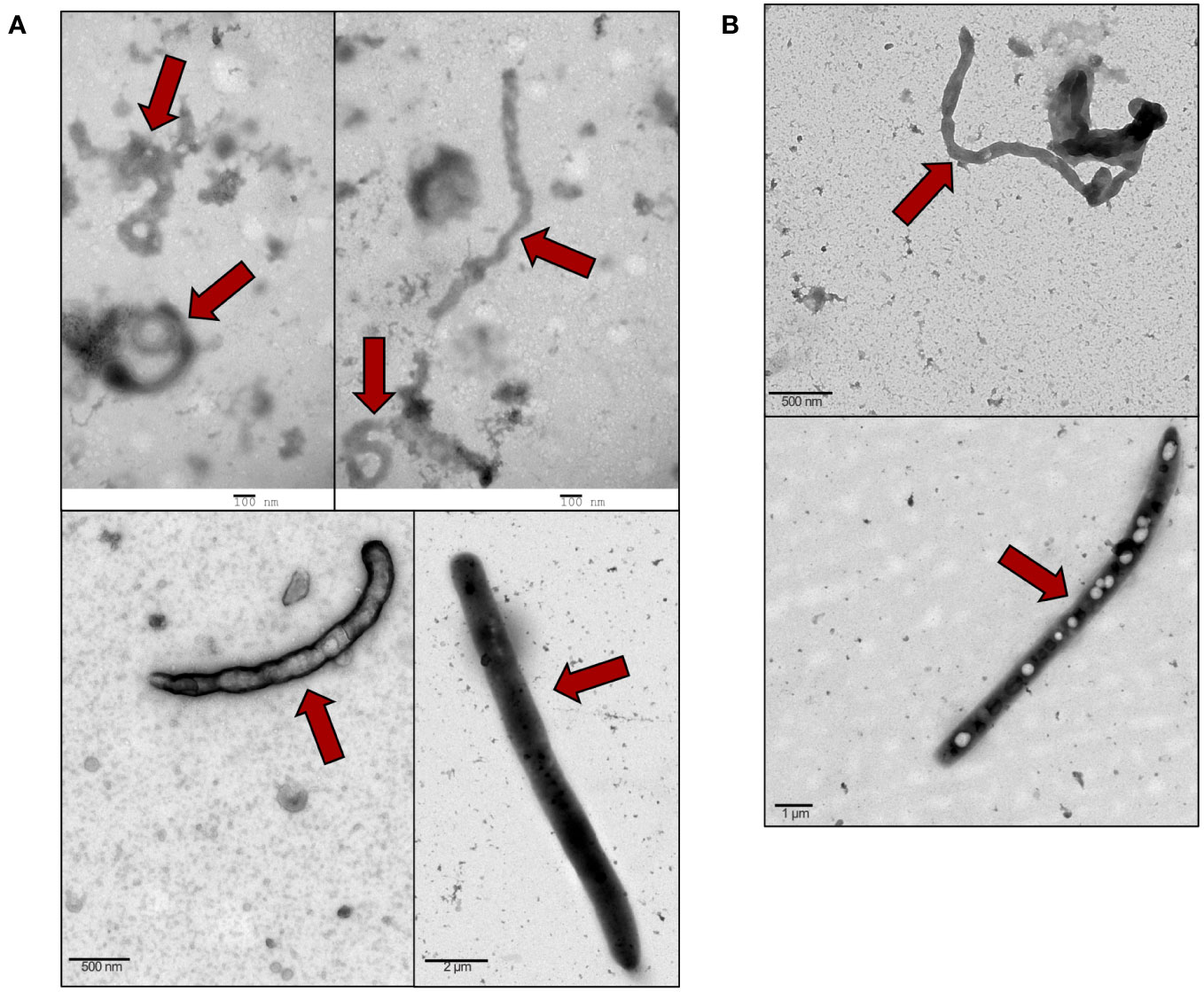 Andrea Vega Hd Porn Video Free Download - Frontiers | Extracellular vesicle storm during the course of Ebola virus  infection in primates