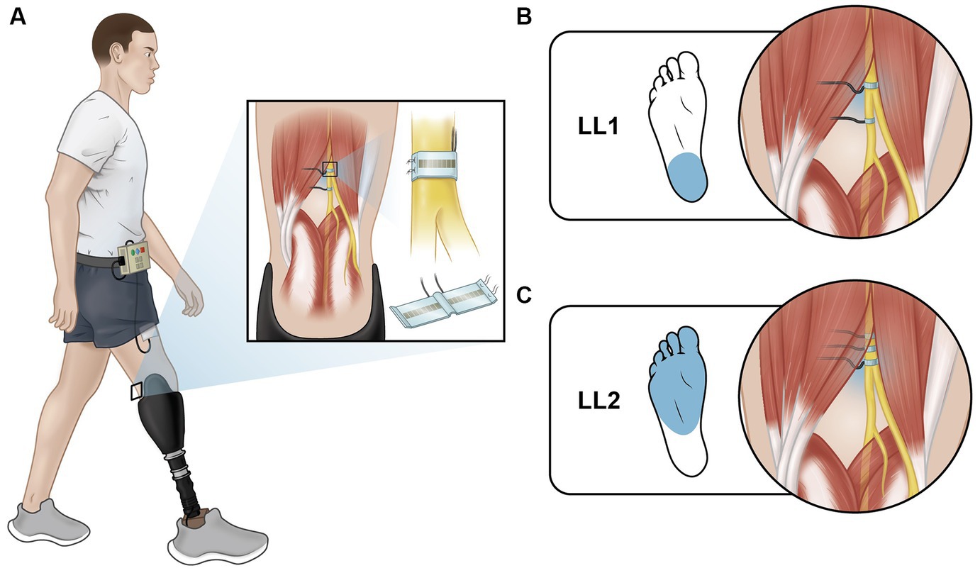 Leg Raise Test - Supine Position - Trial Exhibits Inc.