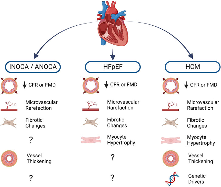 Frontiers | Endothelial cell dysfunction in cardiac disease: driver or  consequence?