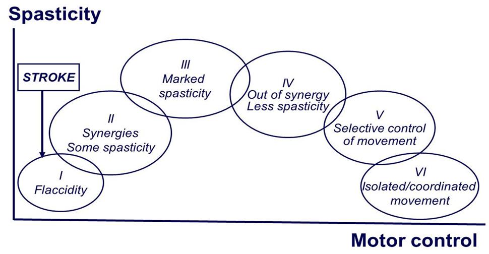 Frontiers New insights into the pathophysiology of poststroke