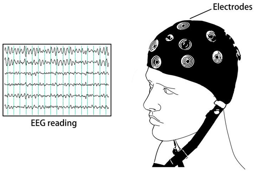 Frontiers | A comprehensive review for machine learning on neuroimaging ...