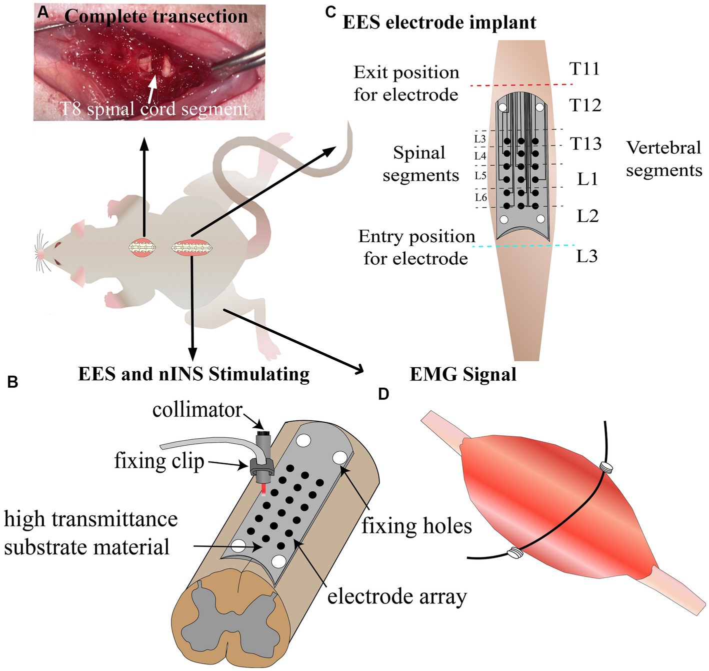 Utilizing a Double Epidural Electrical Stimulation Implant For SCI