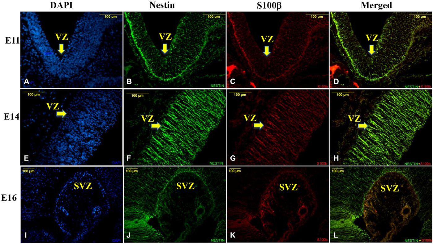 Frontiers Differential Temporal Expression Of S100b In Developing Rat Brain Cellular Neuroscience