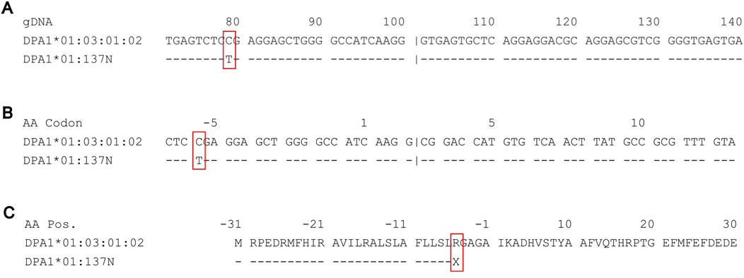 Characterization of the novel HLA‐B*46:41N allele - Zheng - 2020