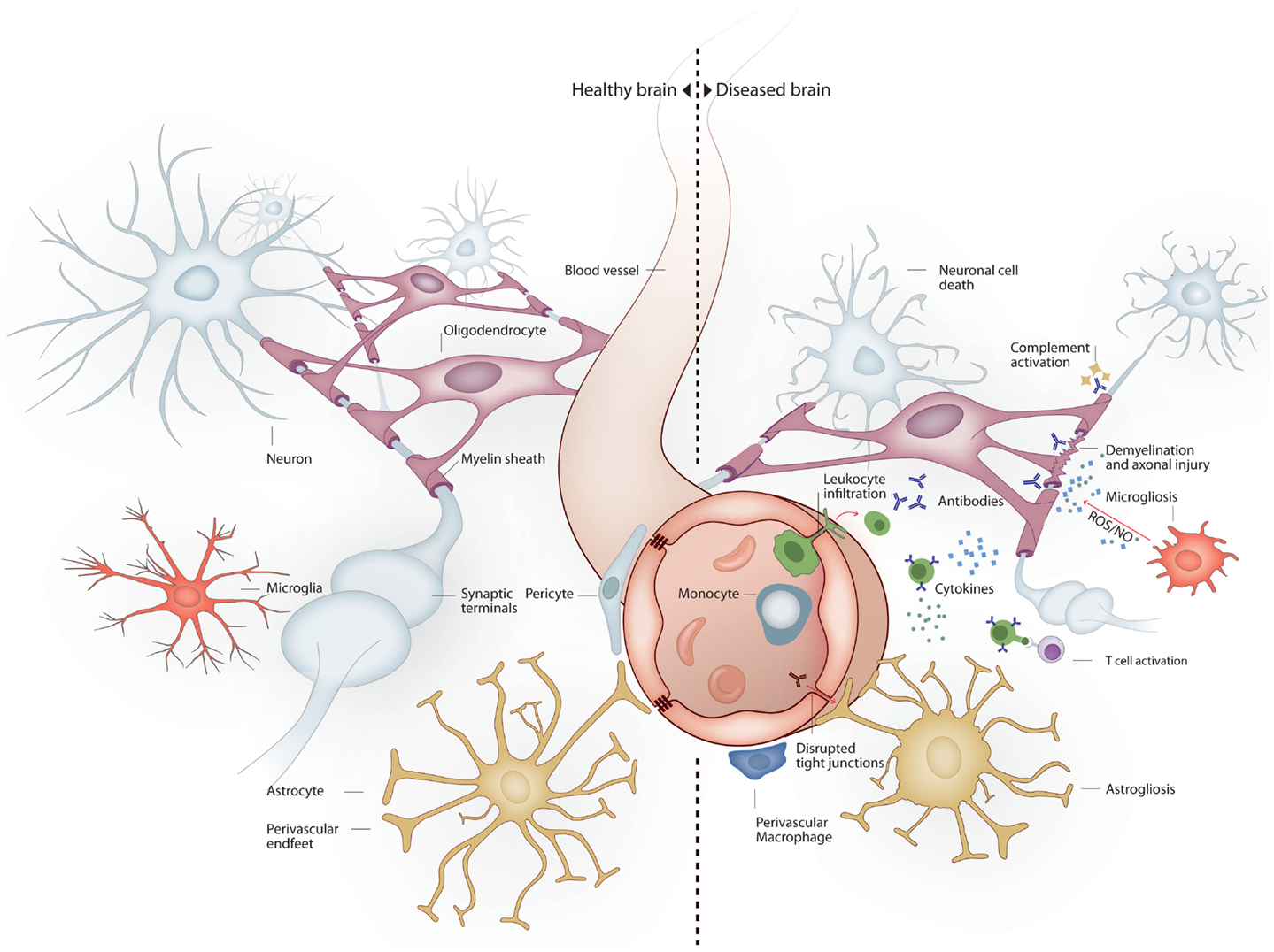 Resultado de imagen para inflamed brain cytokines