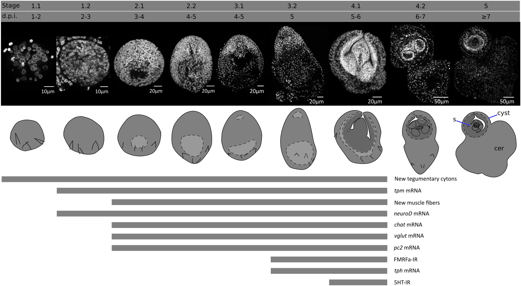 Asagittal section sheep head shows various larval stages bot fly in the