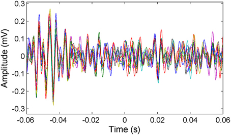 Frontiers | High frequency synchrony in the cerebellar cortex during ...